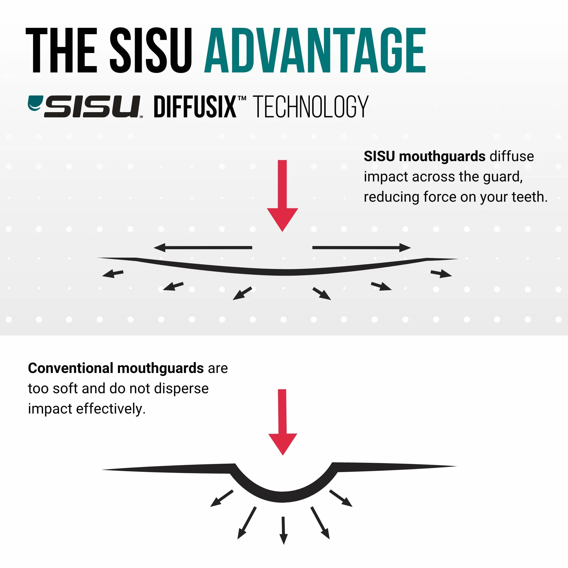 SISU – Protège-Dents Ajustable Areo de Sport pour Jeunes/Adultes, 1,6 mm