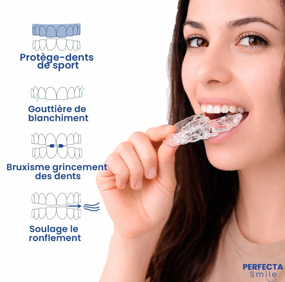 Boston Tech Lot de 10 attelles dentaires pour bruxisme nocturne | Protège-dents pour combler et serrer les dents | Ajustement personnalisé | Utilisation pour le sommeil et le sport | Sans BPA | Étui